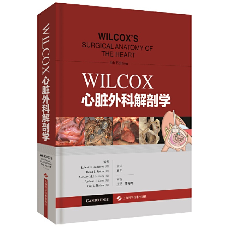 WILCOXKƽʌW(xu)