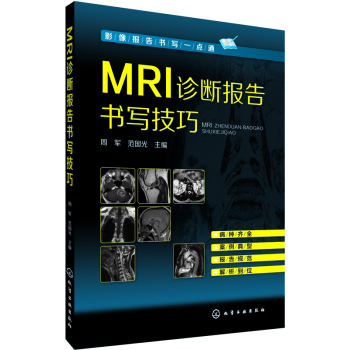 MRI\(bo)